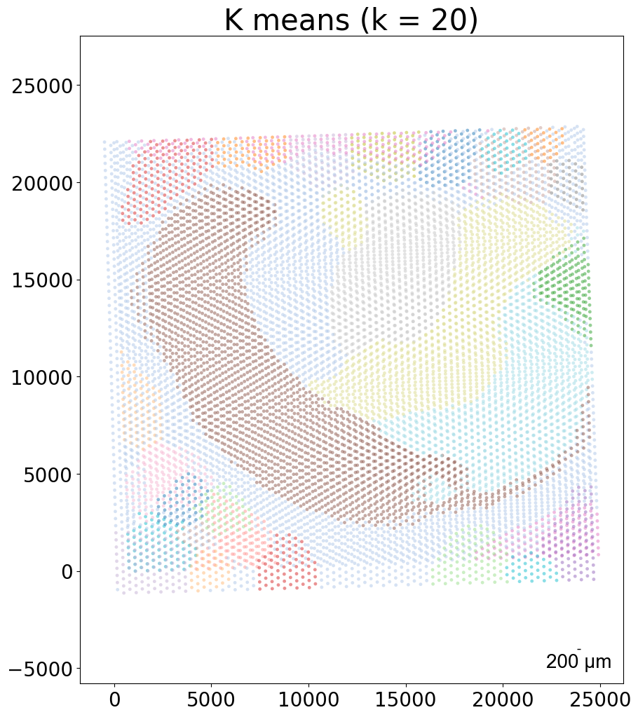 ../_images/notebooks_demo5_Visium_12_9.png